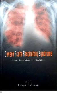 Severe Acute Respiratory Syndrome : From Benchtop to Bedside