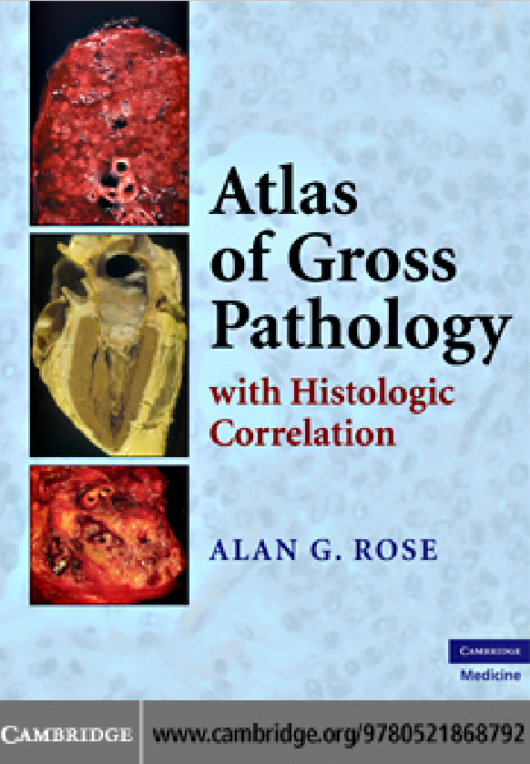 Atlas Of Gross Pathology-With Histologic Correlation