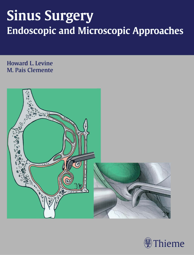 Sinus Surgery - Endoscopic And Microscopic Approaches