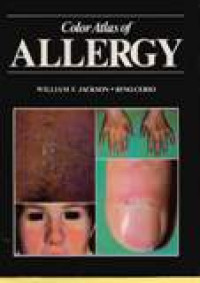 Colour Atlas Of Allergy