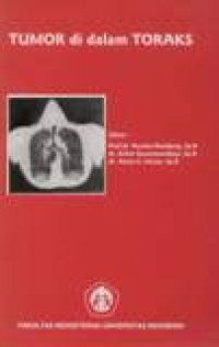 Image of Tumor Di Dalam Toraks