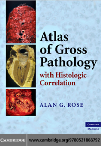 Image of Atlas Of Gross Pathology-With Histologic Correlation